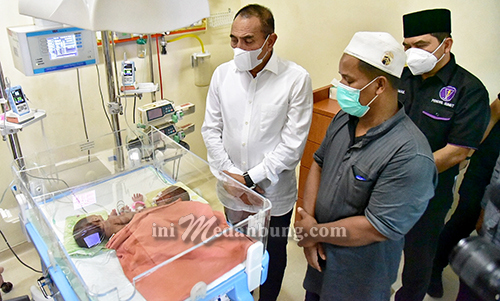 Jenguk Bayi Kembar Siam asal Asahan, Gubernur Jamin Biaya Perobatan si Kembar Ratih dan Ririn