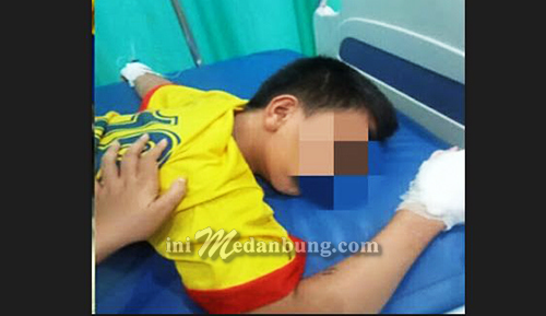 Jari Bocah 13 Tahun Putus Ditebas Kelewang Kelompok Perampok