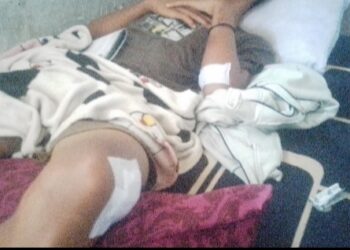 Sàhputra Manik Dibacok saat Bentrok Kelompok 