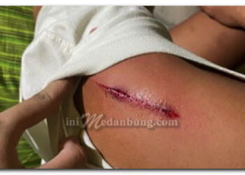 Sepasang Kekasih Dibacok Sepeda Motor Dibegal