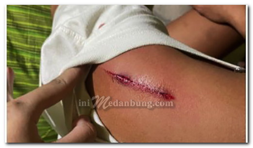 Sepasang Kekasih Dibacok Sepeda Motor Dibegal