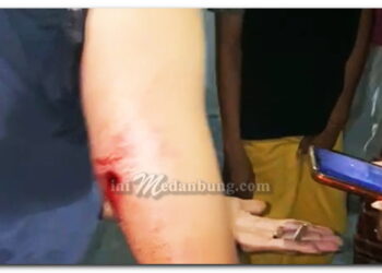 Warga Tertembak Polisi Saat Membubarkan Aksi Bentro di Medan Labuhan